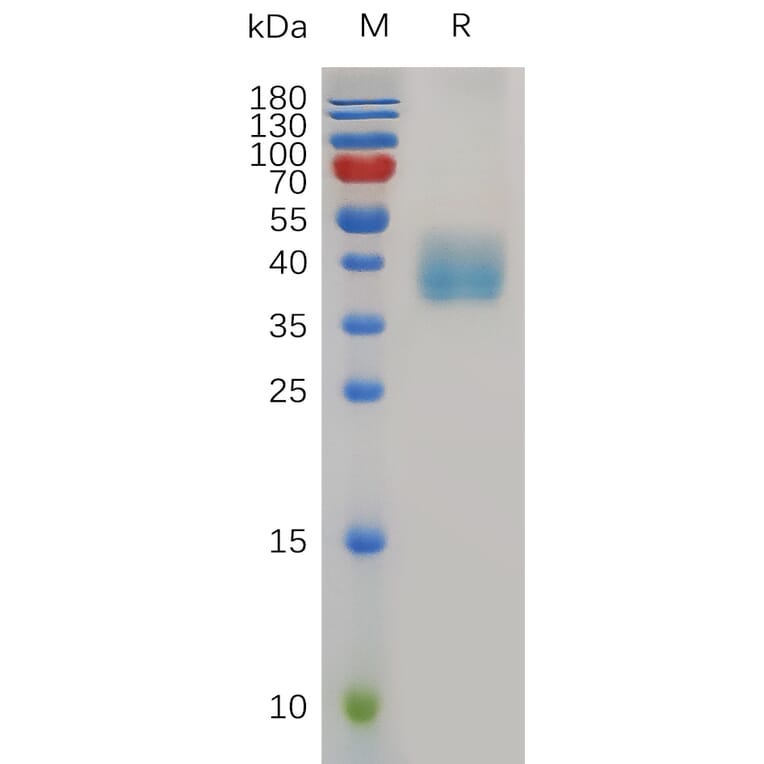 SDS-PAGE - Recombinant Mouse Mesothelin Protein (6×His Tag) (A317500) - Antibodies.com