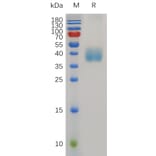SDS-PAGE - Recombinant Mouse Mesothelin Protein (6×His Tag) (A317500) - Antibodies.com