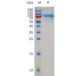 SDS-PAGE - Recombinant Mouse Quiescin Q6 Protein (6×His Tag) (A317501) - Antibodies.com