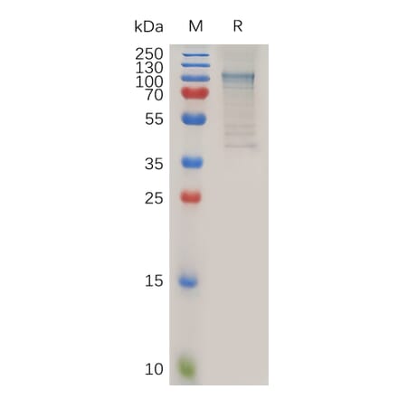 SDS-PAGE - Recombinant Mouse ADAM28 Protein (Fc Tag) (A317502) - Antibodies.com