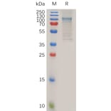 SDS-PAGE - Recombinant Mouse ADAM28 Protein (Fc Tag) (A317502) - Antibodies.com