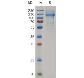 SDS-PAGE - Recombinant Mouse Nucleolin Protein (6×His Tag) (A317503) - Antibodies.com