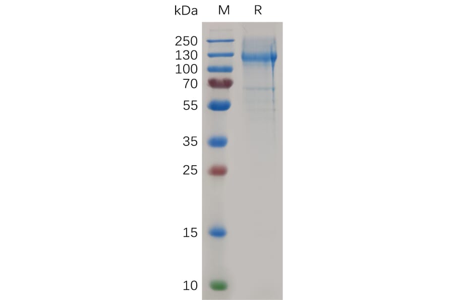 SDS-PAGE - Recombinant Mouse Nucleolin Protein (6×His Tag) (A317503) - Antibodies.com