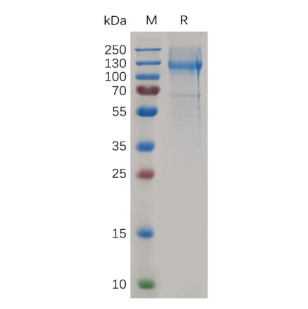 SDS-PAGE - Recombinant Mouse Nucleolin Protein (6×His Tag) (A317503) - Antibodies.com