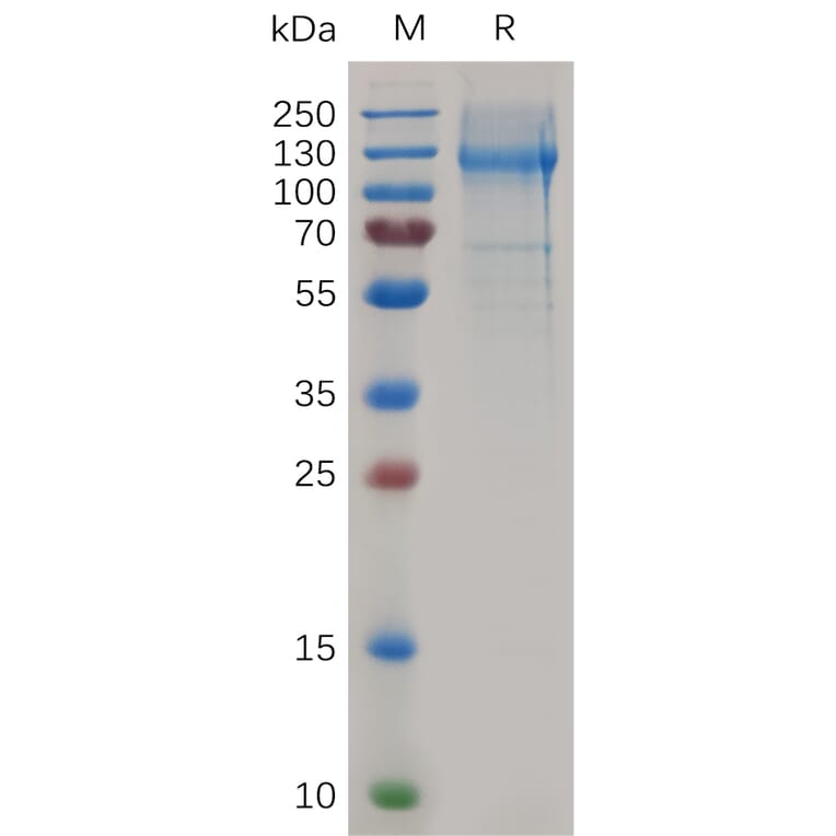 SDS-PAGE - Recombinant Mouse Nucleolin Protein (6×His Tag) (A317503) - Antibodies.com