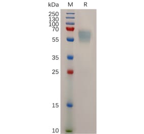 SDS-PAGE - Recombinant Mouse STAB1 Protein (6×His Tag) (A317504) - Antibodies.com