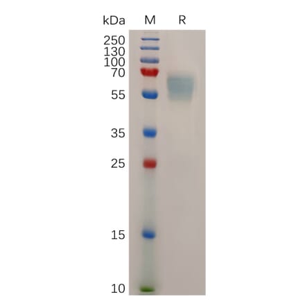 SDS-PAGE - Recombinant Mouse STAB1 Protein (6×His Tag) (A317504) - Antibodies.com