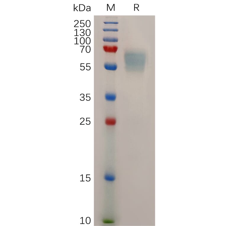 SDS-PAGE - Recombinant Mouse STAB1 Protein (6×His Tag) (A317504) - Antibodies.com