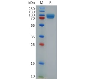 SDS-PAGE - Recombinant Mouse STAB1 Protein (Fc Tag) (A317505) - Antibodies.com