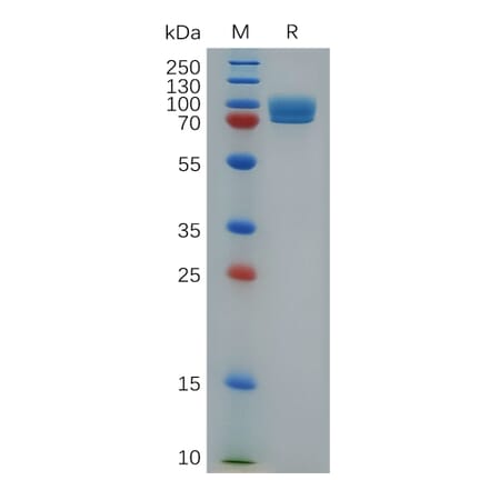 SDS-PAGE - Recombinant Mouse STAB1 Protein (Fc Tag) (A317505) - Antibodies.com