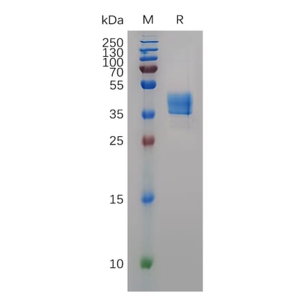 SDS-PAGE - Recombinant Mouse CCR8 Protein (Fc Tag) (A317506) - Antibodies.com