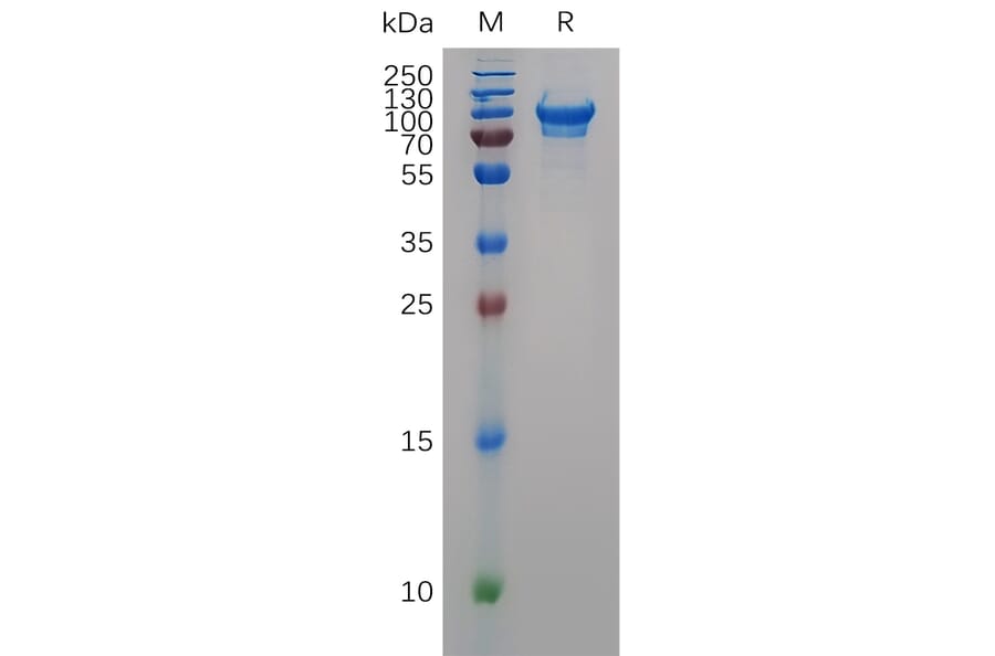 SDS-PAGE - Recombinant Mouse CD93 Protein (6×His Tag) (A317507) - Antibodies.com