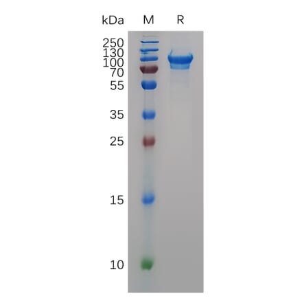 SDS-PAGE - Recombinant Mouse CD93 Protein (6×His Tag) (A317507) - Antibodies.com