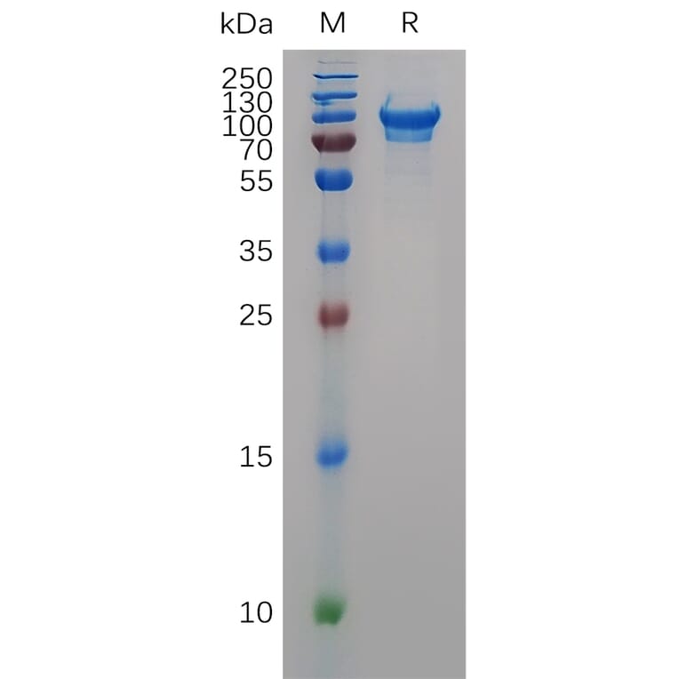 SDS-PAGE - Recombinant Mouse CD93 Protein (6×His Tag) (A317507) - Antibodies.com