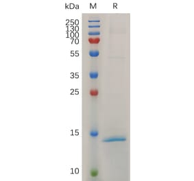 SDS-PAGE - Recombinant Mouse RNASE4 Protein (6×His Tag) (A317508) - Antibodies.com