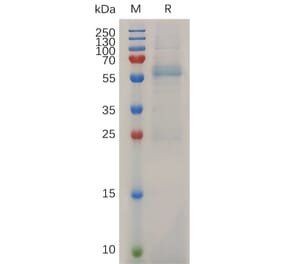 SDS-PAGE - Recombinant Mouse MMP13 Protein (6×His Tag) (A317509) - Antibodies.com