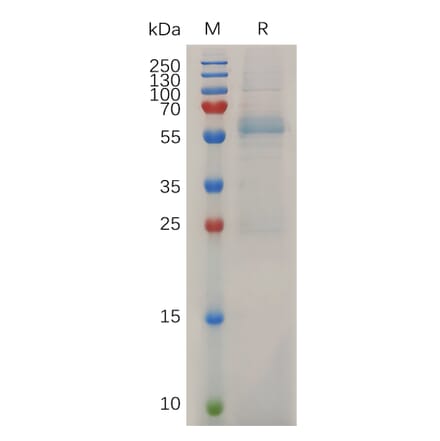 SDS-PAGE - Recombinant Mouse MMP13 Protein (6×His Tag) (A317509) - Antibodies.com