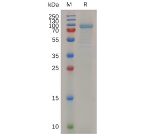 SDS-PAGE - Recombinant Mouse MMP13 Protein (Fc Tag) (A317510) - Antibodies.com