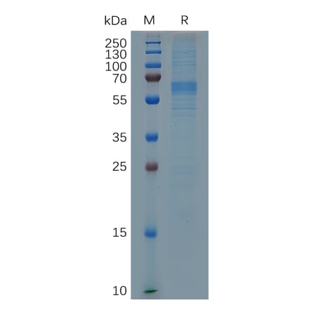 SDS-PAGE - Recombinant Mouse Milk Fat Globule 1 Protein (6×His Tag) (A317513) - Antibodies.com