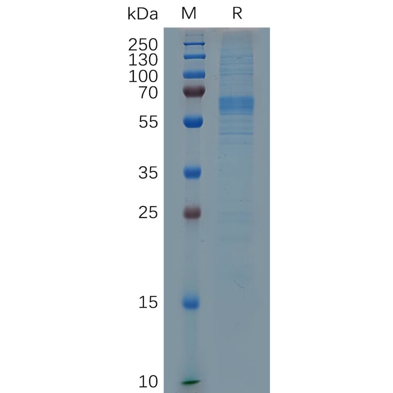 SDS-PAGE - Recombinant Mouse Milk Fat Globule 1 Protein (6×His Tag) (A317513) - Antibodies.com