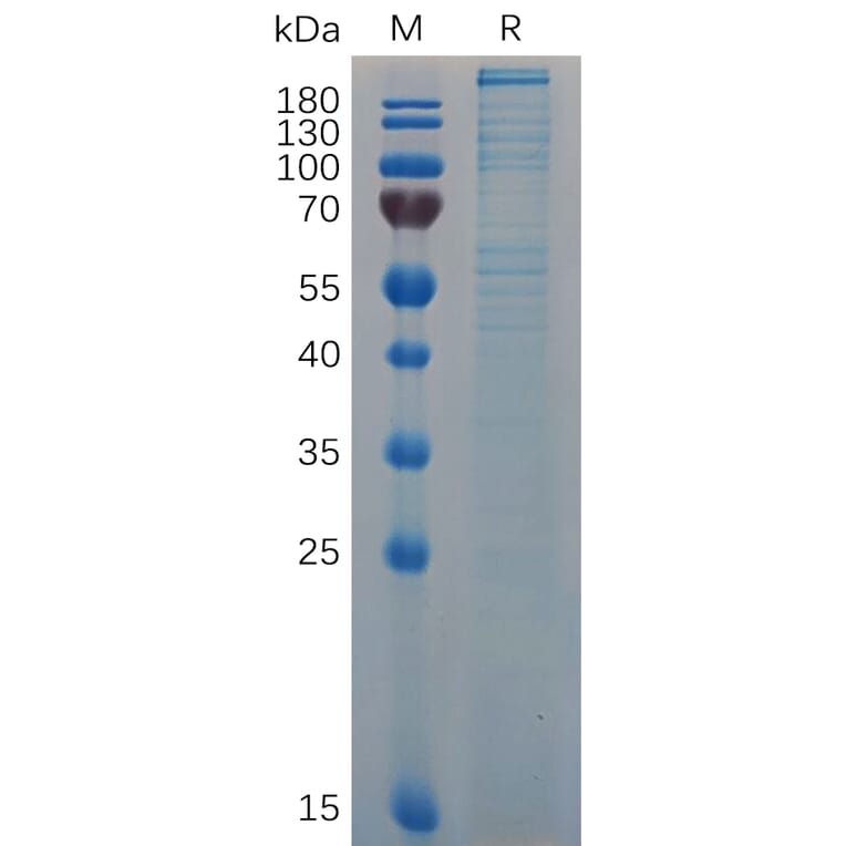 SDS-PAGE - Recombinant Mouse Von Willebrand Factor Protein (6×His Tag) (A317514) - Antibodies.com