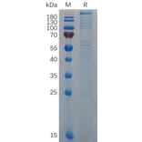 SDS-PAGE - Recombinant Mouse Von Willebrand Factor Protein (6×His Tag) (A317514) - Antibodies.com