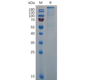 SDS-PAGE - Recombinant Mouse Von Willebrand Factor Protein (6×His Tag) (A317515) - Antibodies.com