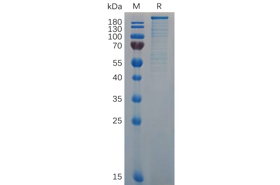 SDS-PAGE - Recombinant Mouse Von Willebrand Factor Protein (6×His Tag) (A317515) - Antibodies.com