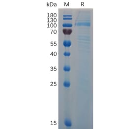 SDS-PAGE - Recombinant Mouse Von Willebrand Factor Protein (6×His Tag) (A317516) - Antibodies.com