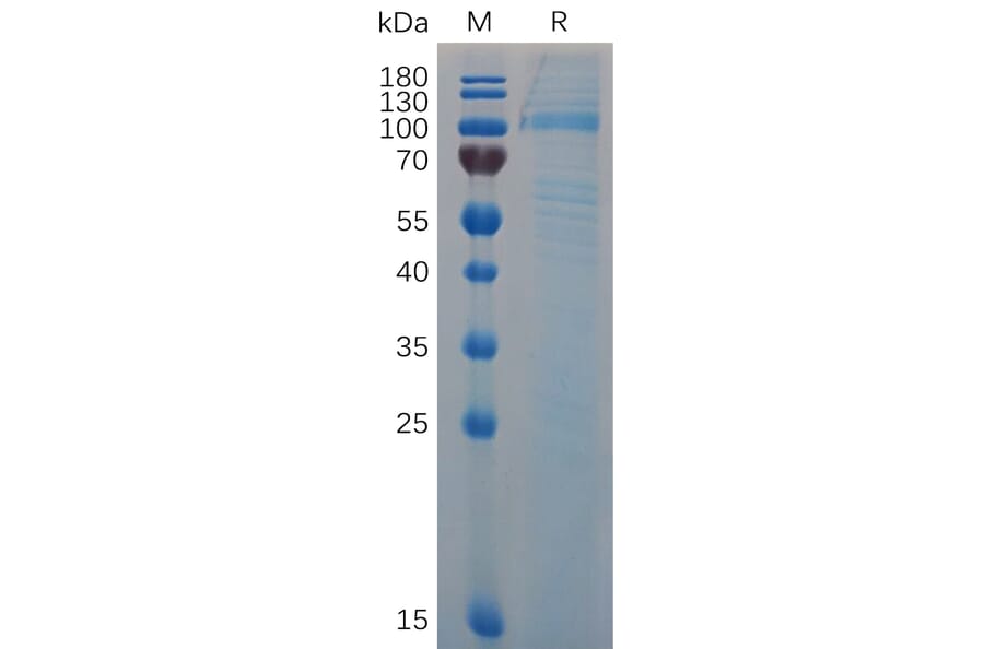 SDS-PAGE - Recombinant Mouse Von Willebrand Factor Protein (6×His Tag) (A317516) - Antibodies.com