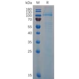 SDS-PAGE - Recombinant Mouse Von Willebrand Factor Protein (6×His Tag) (A317516) - Antibodies.com