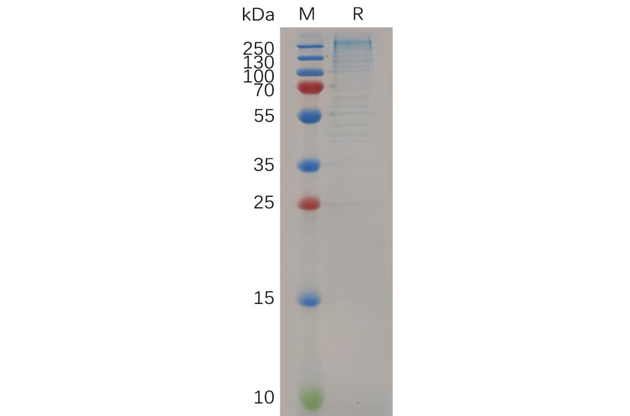 SDS-PAGE - Recombinant Mouse Laminin alpha 4/LAMA4 Protein (6×His Tag) (A317518) - Antibodies.com