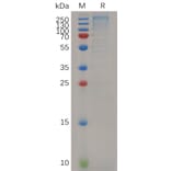 SDS-PAGE - Recombinant Mouse Laminin alpha 4/LAMA4 Protein (6×His Tag) (A317518) - Antibodies.com