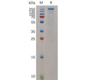 SDS-PAGE - Recombinant Mouse Teneurin-4 Protein (6×His Tag) (A317519) - Antibodies.com