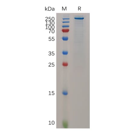 SDS-PAGE - Recombinant Mouse Teneurin-4 Protein (6×His Tag) (A317519) - Antibodies.com