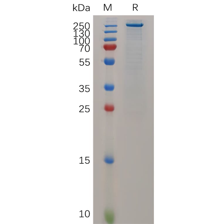 SDS-PAGE - Recombinant Mouse Teneurin-4 Protein (6×His Tag) (A317519) - Antibodies.com