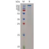 SDS-PAGE - Recombinant Mouse Teneurin-4 Protein (6×His Tag) (A317519) - Antibodies.com
