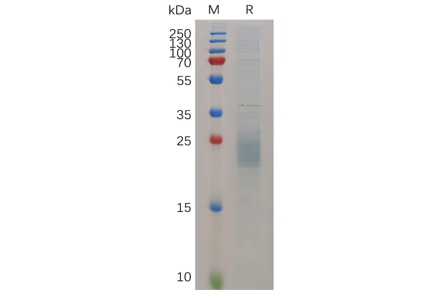 SDS-PAGE - Recombinant Mouse HBEGF/DTR Protein (6×His Tag) (A317520) - Antibodies.com