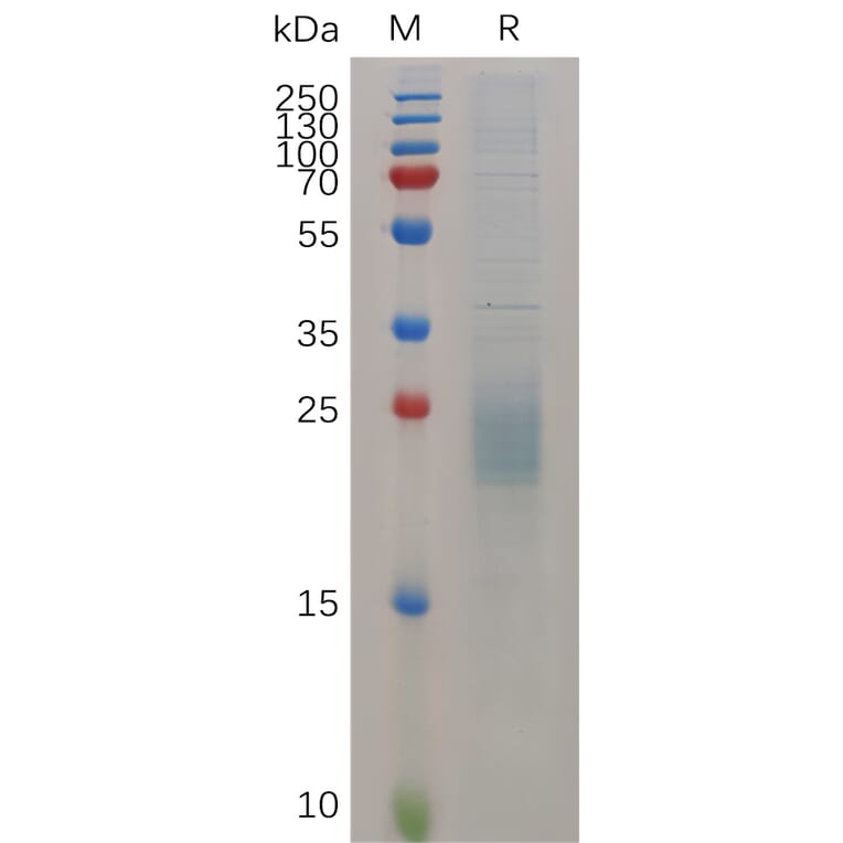 SDS-PAGE - Recombinant Mouse HBEGF/DTR Protein (6×His Tag) (A317520) - Antibodies.com