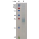 SDS-PAGE - Recombinant Mouse HBEGF/DTR Protein (6×His Tag) (A317520) - Antibodies.com
