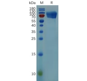 SDS-PAGE - Recombinant Mouse CD30 Protein (Fc Tag) (A317521) - Antibodies.com
