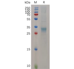 SDS-PAGE - Recombinant Mouse Interferon beta Protein (6×His Tag) (A317523) - Antibodies.com