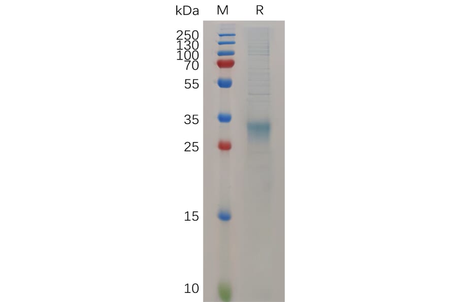 SDS-PAGE - Recombinant Mouse Interferon beta Protein (6×His Tag) (A317523) - Antibodies.com