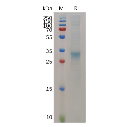 SDS-PAGE - Recombinant Mouse Interferon beta Protein (6×His Tag) (A317523) - Antibodies.com