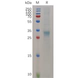 SDS-PAGE - Recombinant Mouse Interferon beta Protein (6×His Tag) (A317523) - Antibodies.com