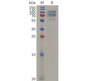 SDS-PAGE - Recombinant Mouse Syndecan-1 Protein (Fc Tag) (A317526) - Antibodies.com
