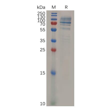 SDS-PAGE - Recombinant Mouse Syndecan-1 Protein (Fc Tag) (A317526) - Antibodies.com