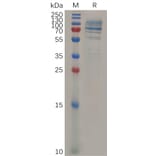 SDS-PAGE - Recombinant Mouse Syndecan-1 Protein (Fc Tag) (A317526) - Antibodies.com