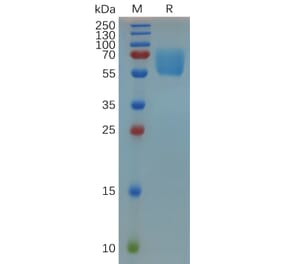 SDS-PAGE - Recombinant Mouse CD47 Protein (Fc Tag) (A317528) - Antibodies.com