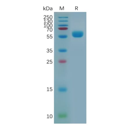 SDS-PAGE - Recombinant Mouse CTLA4 Protein (Fc Tag) (A317530) - Antibodies.com